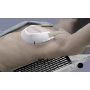Cosmas Cup for Breast Positioning - Size B (Qty. 5)
