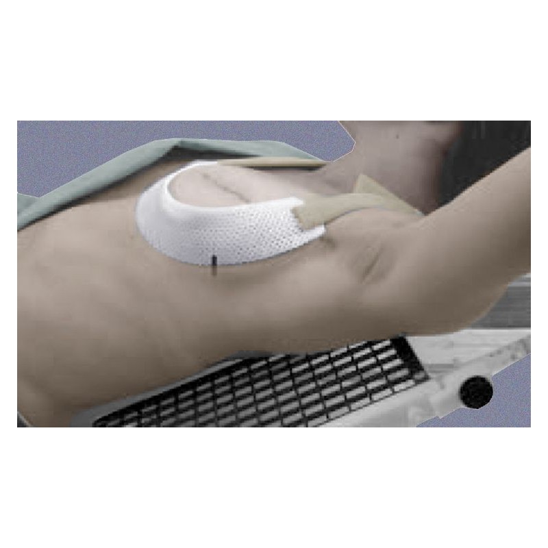 Cosmas Cup for Breast Positioning - Size B (Qty. 5) - Radiation Products  Design, Inc.