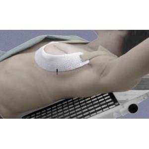 Cosmas Cup for Breast Positioning - Size D (Qty. 5) - Radiation