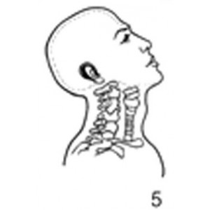 Anatomical Drawings, Right Lateral Extended Head and Neck