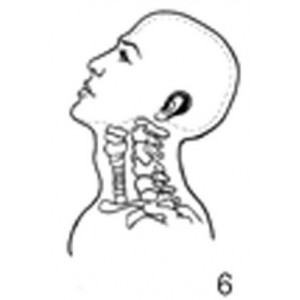 Anatomical Drawings, Left Lateral Extended Head and Neck