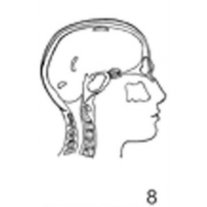 Anatomical Drawings, Right Lateral Sinuses