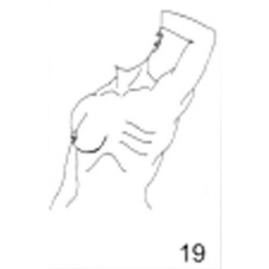 Anatomical Drawings, Left Tangential Chest Wall, 1 Breast
