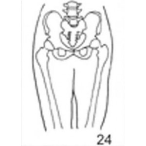 Anatomical Drawings, AP Pelvis and Hips