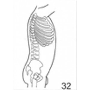 Anatomical Drawings, Right Lateral Male Torso