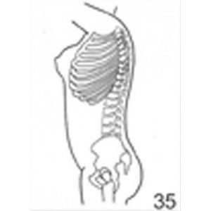 Anatomical Drawings, Left Lateral Female Torso