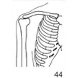 Anatomical Drawings, AP Right Shoulder