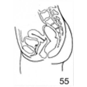 Anatomical Drawings, Female Pelvis, Sagittal Section