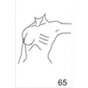 Anatomical Drawings, Left Tangential CW, Arm 90 Degree, 1 Breast