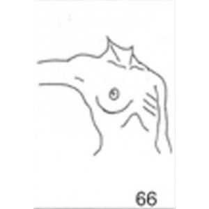 Anatomical Drawings, Right Tangential, Arm 90 Degree, 1 Breast