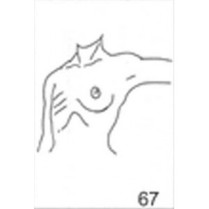 Anatomical Drawings, Left Tangential, Arm 90 Degree, 1 Breast