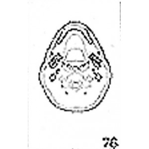 Anatomical Drawings, CT, Axis