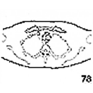 Anatomical Drawings, CT, 1st Thoracic Vertebra