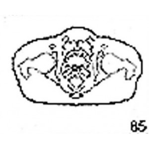 Anatomical Drawings, CT, Bladder