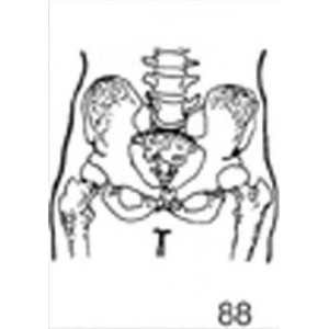 Anatomical Drawings, AP Pelvis